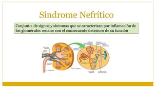 Síndrome Nefrítico
Conjunto de signos y síntomas que se caracterizan por inflamación de
los glomérulos renales con el consecuente deterioro de su función
 
