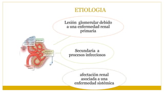 ETIOLOGIA
Lesión glomerular debido
a una enfermedad renal
primaria
Secundaria a
procesos infecciosos
afectación renal
asociada a una
enfermedad sistémica
 