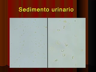 Sedimento urinarioSedimento urinario
 