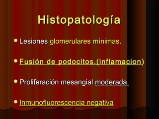 HistopatologíaHistopatología
LesionesLesiones glomerulares mínimas.glomerulares mínimas.
Fusión de podocitos.(inflamacionFusión de podocitos.(inflamacion ))
Proliferación mesangialProliferación mesangial moderada.moderada.
Inmunofluorescencia negativaInmunofluorescencia negativa
 