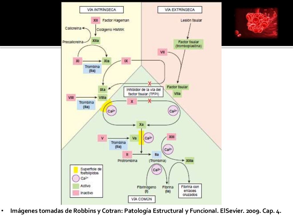 Síndrome por anticuerpos antifosfolípidos