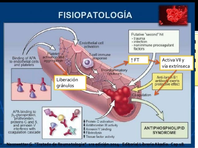 Síndrome por anticuerpos antifosfolípidos