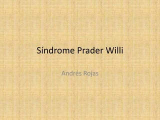 Síndrome Prader Willi

     Andrés Rojas
 