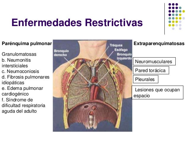 Síndrome pulmonar restrictivo