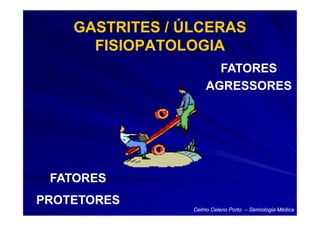 GASTRITES / ÚLCERAS
      FISIOPATOLOGIA
                       FATORES
                     AGRESSORES




 FATORES
PROTETORES
                 Celmo Celeno Porto – Semiologia Médica
 