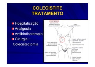 COLECISTITE
            TRATAMENTO

 Hospitalização
 Analgesia
 Antibioticoterapia
 Cirurgia :
Colecistectomia
 