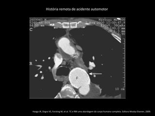 História remota de acidente automotor




Haaga JR, Dogra VS, Forsting M, et al. TC e RM uma abordagem do corpo humano completa. Editora Mosby-Elsevier, 2009.
 