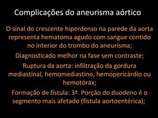 Complicações do aneurisma aórtico
O sinal do crescente hiperdenso na parede da aorta
 representa hematoma agudo com sangue contido
        no interior do trombo do aneurisma;
   Diagnosticado melhor na fase sem contraste;
      Ruptura da aorta: infiltração da gordura
mediastinal, hemomediastino, hemopericárdio ou
                     hemotórax;
  Formação de fístula: 3ª. Porção do duodeno é o
  segmento mais afetado (fístula aortoentérica);
 