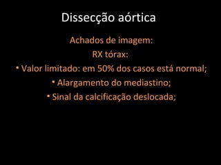 Dissecção aórtica
                Achados de imagem:
                      RX tórax:
• Valor limitado: em 50% dos casos está normal;
           • Alargamento do mediastino;
         • Sinal da calcificação deslocada;
 