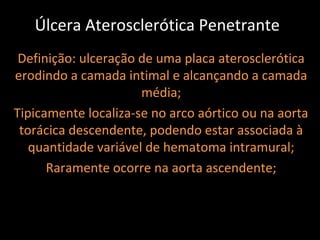 Úlcera Aterosclerótica Penetrante
 Definição: ulceração de uma placa aterosclerótica
erodindo a camada intimal e alcançando a camada
                      média;
Tipicamente localiza-se no arco aórtico ou na aorta
 torácica descendente, podendo estar associada à
   quantidade variável de hematoma intramural;
      Raramente ocorre na aorta ascendente;
 