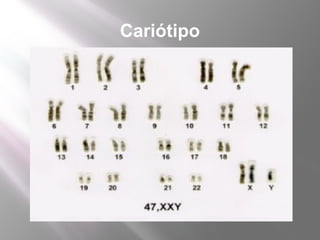 Cariótipo
 