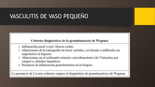 VASCULITIS DE VASO PEQUEÑO
 