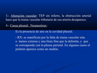 3.- Alteración vascular: TEP sin infarto, la obstrucción arterial
hace que la trama vascular tributaria de esa arteria desaparece.
4.- Causa pleural: Neumotórax:
Es la presencia de aire en la cavidad pleural.
- RX: se manifiesta por la falta de trama vascular más
o menos extensa y una línea fina que la delimita, y que
se corresponde con la pleura parietal. En algunos casos el
pulmón aparece como un muñón.
 
