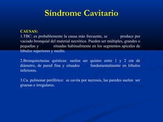 Síndrome Cavitario
CAUSAS:
1.TBC: es probablemente la causa más frecuente, se produce por
vaciado bronquial del material necrótico. Pueden ser múltiples, grandes o
pequeñas y situadas habitualmente en los segmentos apicales de
lóbulos superiores y medio.
2.Bronquiectasias quísticas: suelen ser quistes entre 1 y 2 cm de
diámetro, de pared fina y situados fundamentalmente en lóbulos
inferiores.
3.Ca. pulmonar periférico: se cavita por necrosis, las paredes suelen ser
gruesas e irregulares.
 