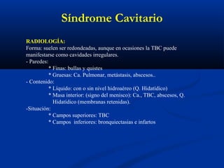 Síndrome Cavitario
RADIOLOGÍA:
Forma: suelen ser redondeadas, aunque en ocasiones la TBC puede
manifestarse como cavidades irregulares.
- Paredes:
* Finas: bullas y quistes
* Gruesas: Ca. Pulmonar, metástasis, abscesos..
- Contenido:
* Líquido: con o sin nivel hidroaéreo (Q. Hidatídico)
* Masa interior: (signo del menisco): Ca., TBC, abscesos, Q.
Hidatídico (membranas retenidas).
-Situación:
* Campos superiores: TBC
* Campos inferiores: bronquiectasias e infartos
 