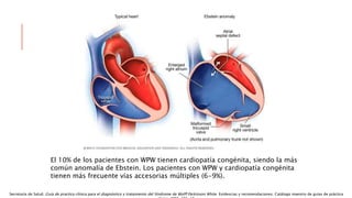 El 10% de los pacientes con WPW tienen cardiopatía congénita, siendo la más
común anomalía de Ebstein. Los pacientes con WPW y cardiopatía congénita
tienen más frecuente vías accesorias múltiples (6-9%).
Secretaría de Salud. Guía de practica clínica para el diagnóstico y tratamiento del Síndrome de Wolff Parkinson White. Evidencias y recomendaciones. Catálogo maestro de guías de práctica
 