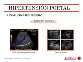 Enfermería Médico-quirúrgica
6. EVALUCIÓN-SEGUIMIENTO
seguimiento ecográfico
Derivados del estudio Doppler Escala de grises
 