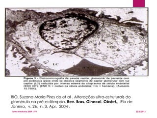 22/5/2013Turma medicina 2009.1/P9
7
RIO, Suzana Maria Pires do et al . Alterações ultra-estruturais do
glomérulo na pré-eclâmpsia. Rev. Bras. Ginecol. Obstet., Rio de
Janeiro, v. 26, n. 3, Apr. 2004 .
 