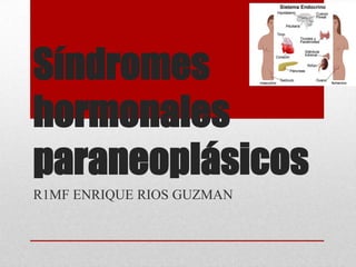 Síndromes
hormonales
paraneoplásicos
R1MF ENRIQUE RIOS GUZMAN
 