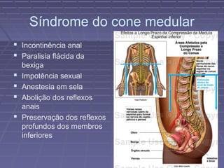 Síndrome do cone medular 
 Incontinência anal 
 Paralisia flácida da 
bexiga 
 Impotência sexual 
 Anestesia em sela 
 Abolição dos reflexos 
anais 
 Preservação dos reflexos 
profundos dos membros 
inferiores 
 