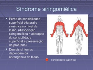 Síndrome siringomiélica 
 Perda da sensibilidade 
superficial bilateral e 
simétrica no nível da 
lesão, (dissociação 
siringomiélica = alteração 
da sensibilidade 
superficial e preservação 
da profunda) 
 Demais sintomas 
dependem da 
abrangência da lesão 
Sensibilidade superficial 
 