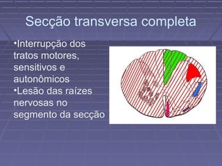 Secção transversa completa 
•Interrupção dos 
tratos motores, 
sensitivos e 
autonômicos 
•Lesão das raízes 
nervosas no 
segmento da secção 
 
