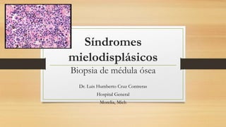 Síndromes
mielodisplásicos
Biopsia de médula ósea
Dr. Luis Humberto Cruz Contreras
Hospital General
Morelia, Mich
 