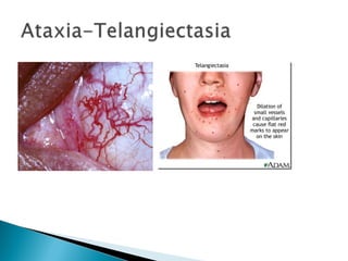 Síndromes neurocutâneas fabio