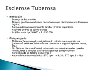  Introdução 
◦ Doença de Bourneville 
◦ Doença genética com lesões hamartomatosas distribuídas por diferentes 
órgãos. 
◦ Forma autossômica dominante familiar ; Forma esporádica 
◦ Acomete ambos os sexos e raças 
◦ Incidência de 1 p/ 10.000 a 1 p/ 50.000 
 Fisiopatogenia 
◦ Malformações em órgãos originários do ectoderma e mesoderma 
( adenoma sebáceo, rabdomiomas cardíacos e angiomiolipomas renais, 
etc.). 
◦ No Sistema Nervoso Central → hamartomas do córtex e das paredes 
ventriculares e tumores das células gigantes subependimais 
( proximidade do forame de Monroe ). 
◦ Anormalidade cromossômica: ETC tipo 1 → 9q34; ETC tipo 2 → 16p 
 