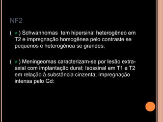 NF2
( v ) Schwannomas tem hipersinal heterogêneo em
T2 e impregnação homogênea pelo contraste se
pequenos e heterogênea se grandes;
( v ) Meningeomas caracterizam-se por lesão extra-
axial com implantação dural; Isossinal em T1 e T2
em relação à substância cinzenta; Impregnação
intensa pelo Gd:
 