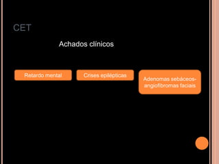 CET
Achados clínicos
Retardo mental Crises epilépticas
Adenomas sebáceos-
angiofibromas faciais
 