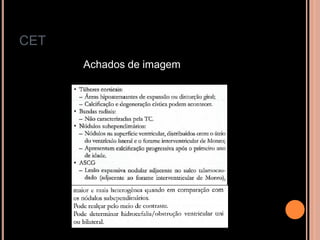 CET
Achados de imagem
 