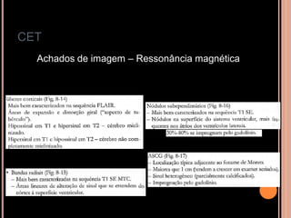 CET
Achados de imagem – Ressonância magnética
 
