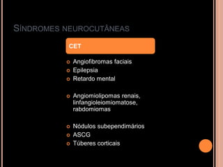SÍNDROMES NEUROCUTÂNEAS
 Angiofibromas faciais
 Epilepsia
 Retardo mental
 Angiomiolipomas renais,
linfangioleiomiomatose,
rabdomiomas
 Nódulos subependimários
 ASCG
 Túberes corticais
CET
 
