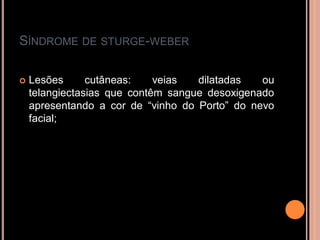 SÍNDROME DE STURGE-WEBER
 Lesões cutâneas: veias dilatadas ou
telangiectasias que contêm sangue desoxigenado
apresentando a cor de “vinho do Porto” do nevo
facial;
 