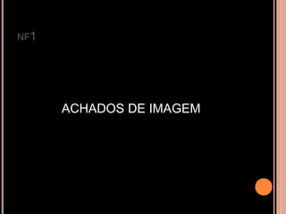 NF1
ACHADOS DE IMAGEM
 