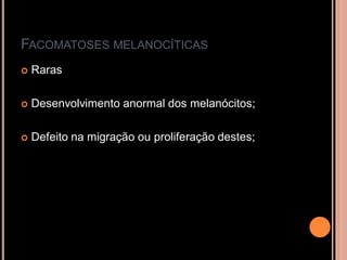 FACOMATOSES MELANOCÍTICAS
 Raras
 Desenvolvimento anormal dos melanócitos;
 Defeito na migração ou proliferação destes;
 