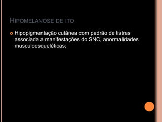 HIPOMELANOSE DE ITO
 Hipopigmentação cutânea com padrão de listras
associada a manifestações do SNC, anormalidades
musculoesqueléticas;
 
