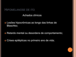 HIPOMELANOSE DE ITO
Achados clínicos
 Lesões hipocrômicas ao longo das linhas de
Blaschko;
 Retardo mental ou desordens de comportamento;
 Crises epilépticas no primeiro ano de vida;
 