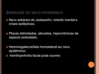 SÍNDROME DO NEVO EPIDÉRMICO
 Nevo sebáceo de Jadassohn, retardo mental e
crises epilépticas;
 Placas delimitadas, elevadas, hipercrômicas de
aspecto aveludado;
 Hemimegalencefalia homolateral ao nevo
epidérmico;
 hemihipertrofia facial pode ocorrer;
 