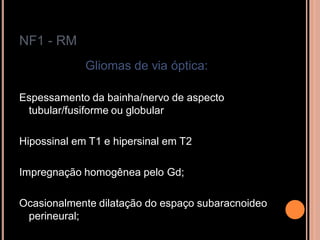 NF1 - RM
Gliomas de via óptica:
Espessamento da bainha/nervo de aspecto
tubular/fusiforme ou globular
Hipossinal em T1 e hipersinal em T2
Impregnação homogênea pelo Gd;
Ocasionalmente dilatação do espaço subaracnoideo
perineural;
 