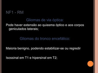 NF1 - RM
Gliomas de via óptica:
Pode haver extensão ao quiasma óptico e aos corpos
geniculados laterais;
Gliomas do tronco encefálico:
Maioria benigno, podendo estabilizar-se ou regredir
Isossinal em T1 e hipersinal em T2;
 