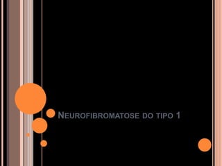 NEUROFIBROMATOSE DO TIPO 1
 