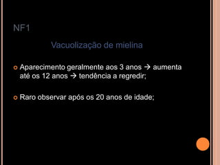 NF1
Vacuolização de mielina
 Aparecimento geralmente aos 3 anos  aumenta
até os 12 anos  tendência a regredir;
 Raro observar após os 20 anos de idade;
 