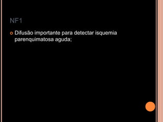 NF1
 Difusão importante para detectar isquemia
parenquimatosa aguda;
 