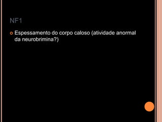 NF1
 Espessamento do corpo caloso (atividade anormal
da neurobrimina?)
 