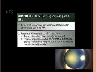 NF2
 