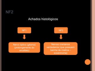NF2
Achados histológicos
NF1 NF2
Nervo óptico (glioma)
(prolongamento do
encéfalo)
Nervos cranianos
verdadeiros (que possuem
bainha de mielina –
scwannoma)
 