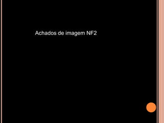Achados de imagem NF2
 