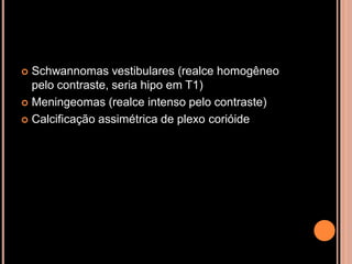  Schwannomas vestibulares (realce homogêneo
pelo contraste, seria hipo em T1)
 Meningeomas (realce intenso pelo contraste)
 Calcificação assimétrica de plexo corióide
 